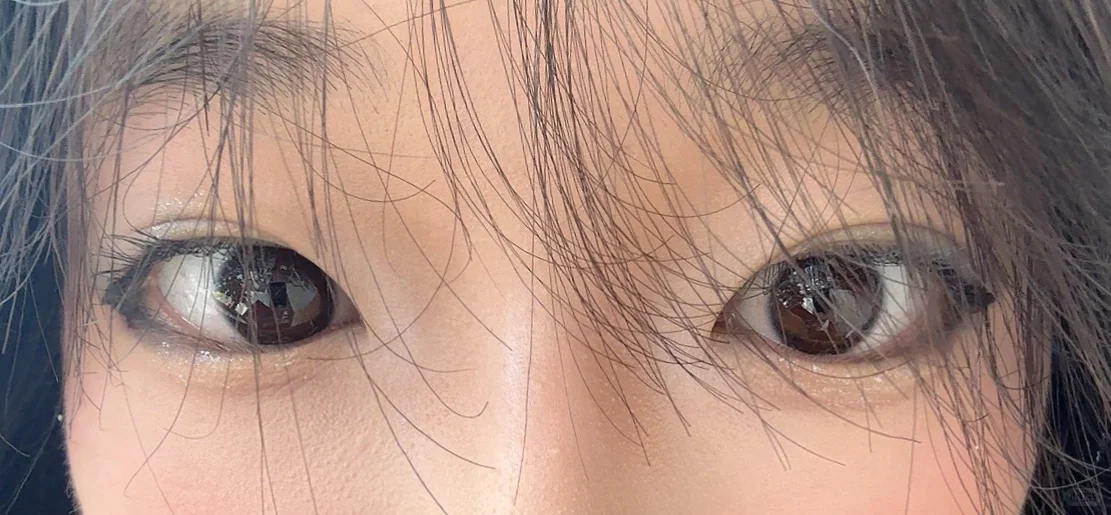 我这个是斜视吗?