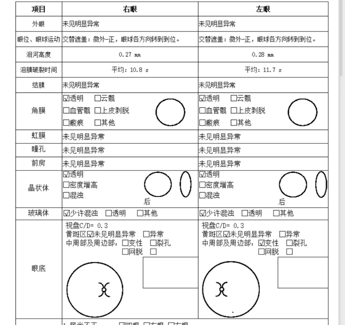 近视眼手术建议