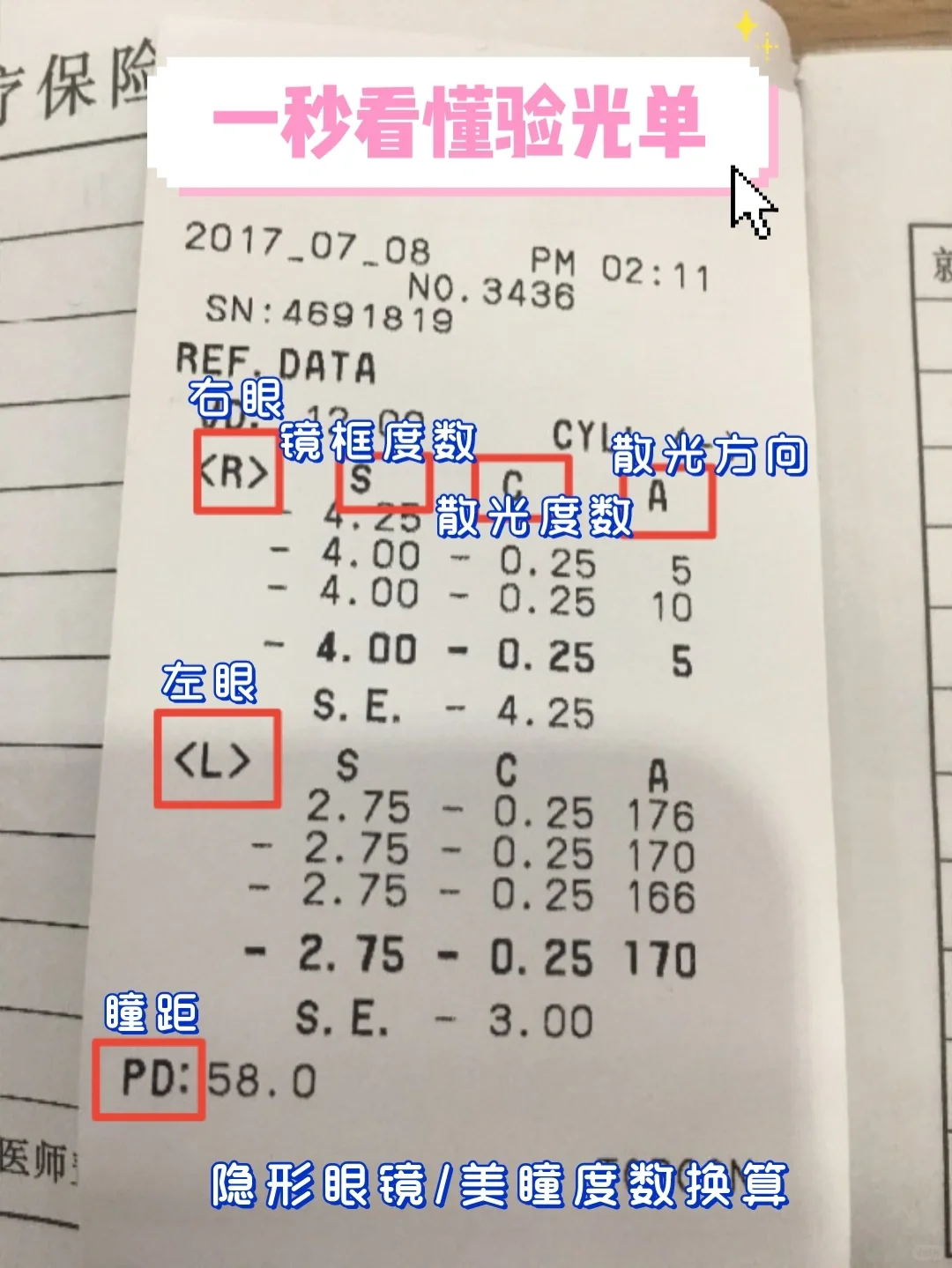 隐形眼镜度数如何换算❓含散光！新手必?