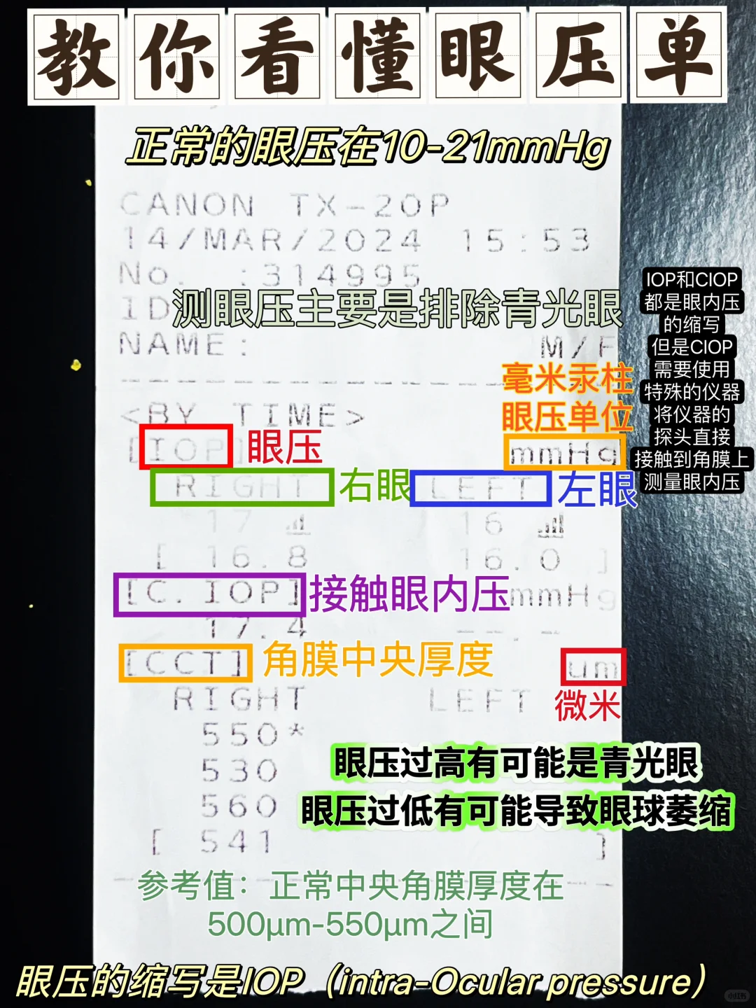 如何通过✅验光单、眼压单看懂你的眼睛?度数