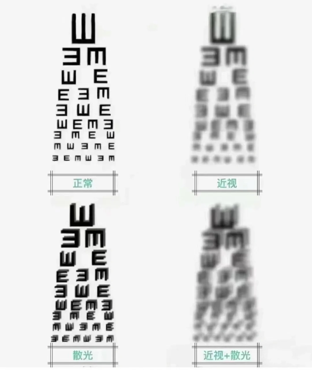 正视眼和近视、散光眼的区别这么大?