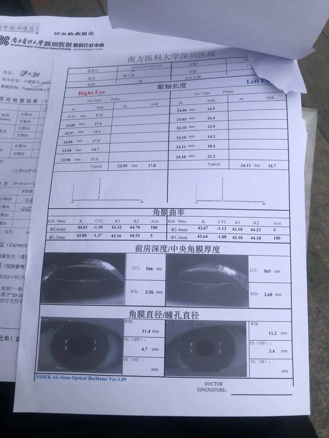 验光报告有大神可以帮忙看一下吗