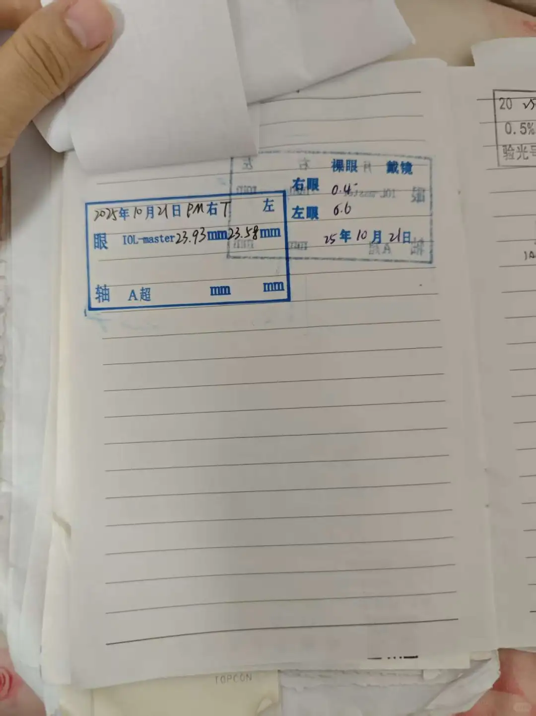 散瞳后验光比散瞳前度数还大？怎么配镜