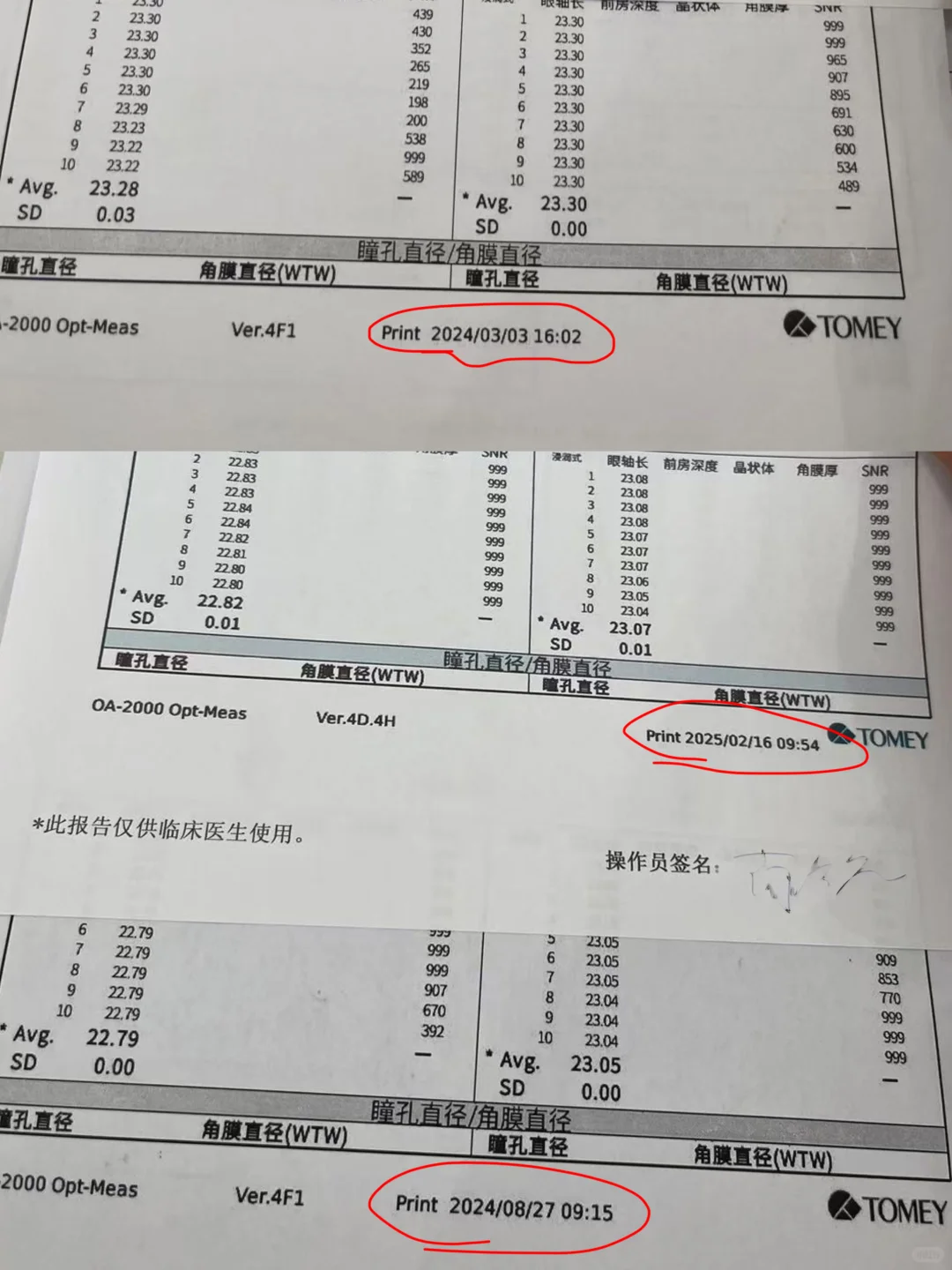 控优点一年,度数降100度‼️郑州配眼镜