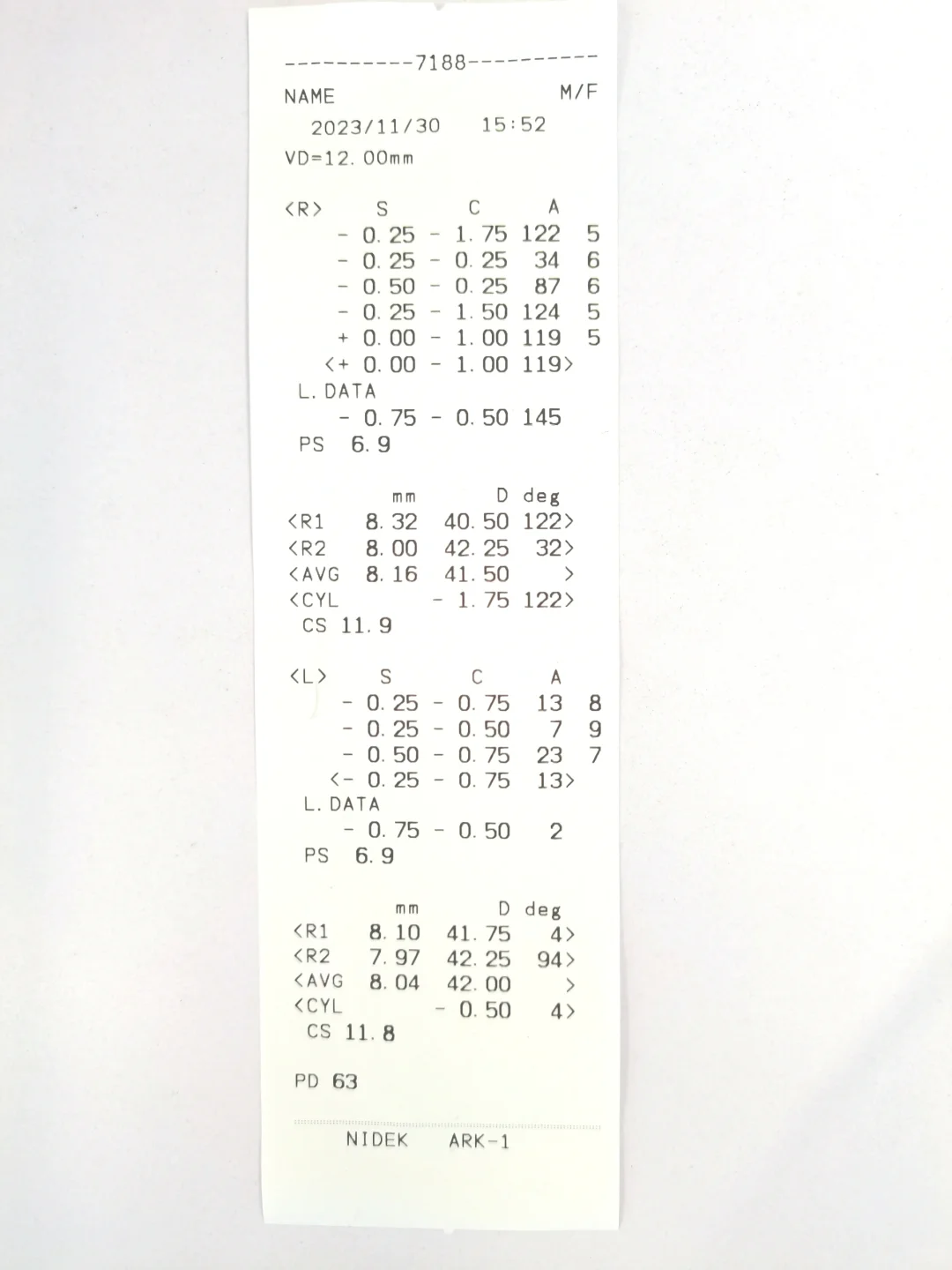 检查视力结果你会看吗？