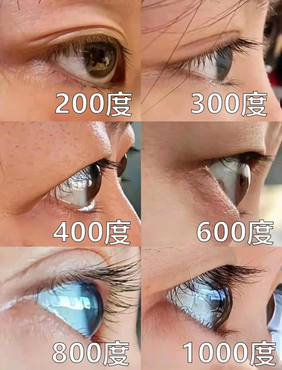 一张图看明白近视多少度