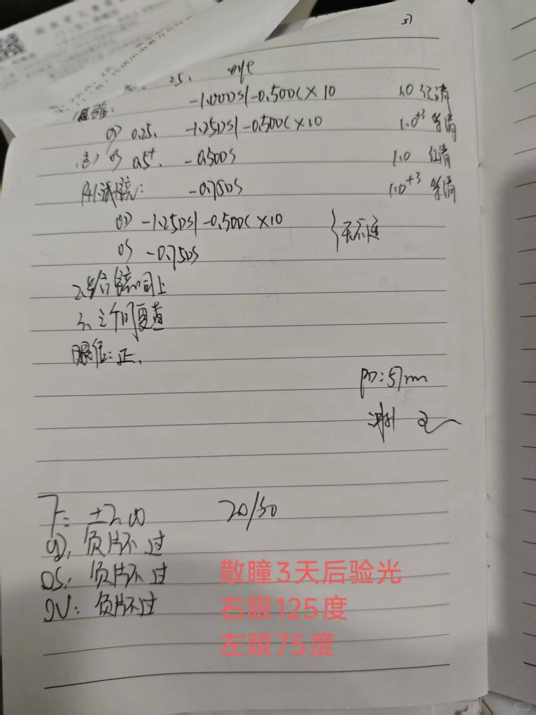 散瞳后验光比散瞳前度数还大？怎么配镜