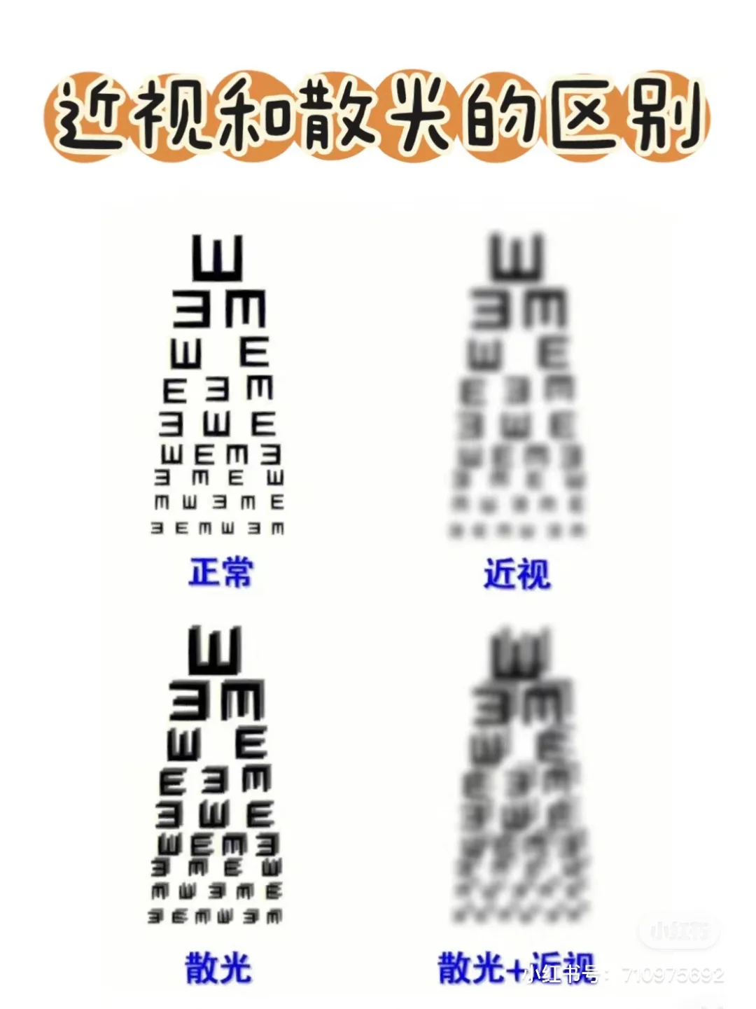 一张图告诉你近视和散光！