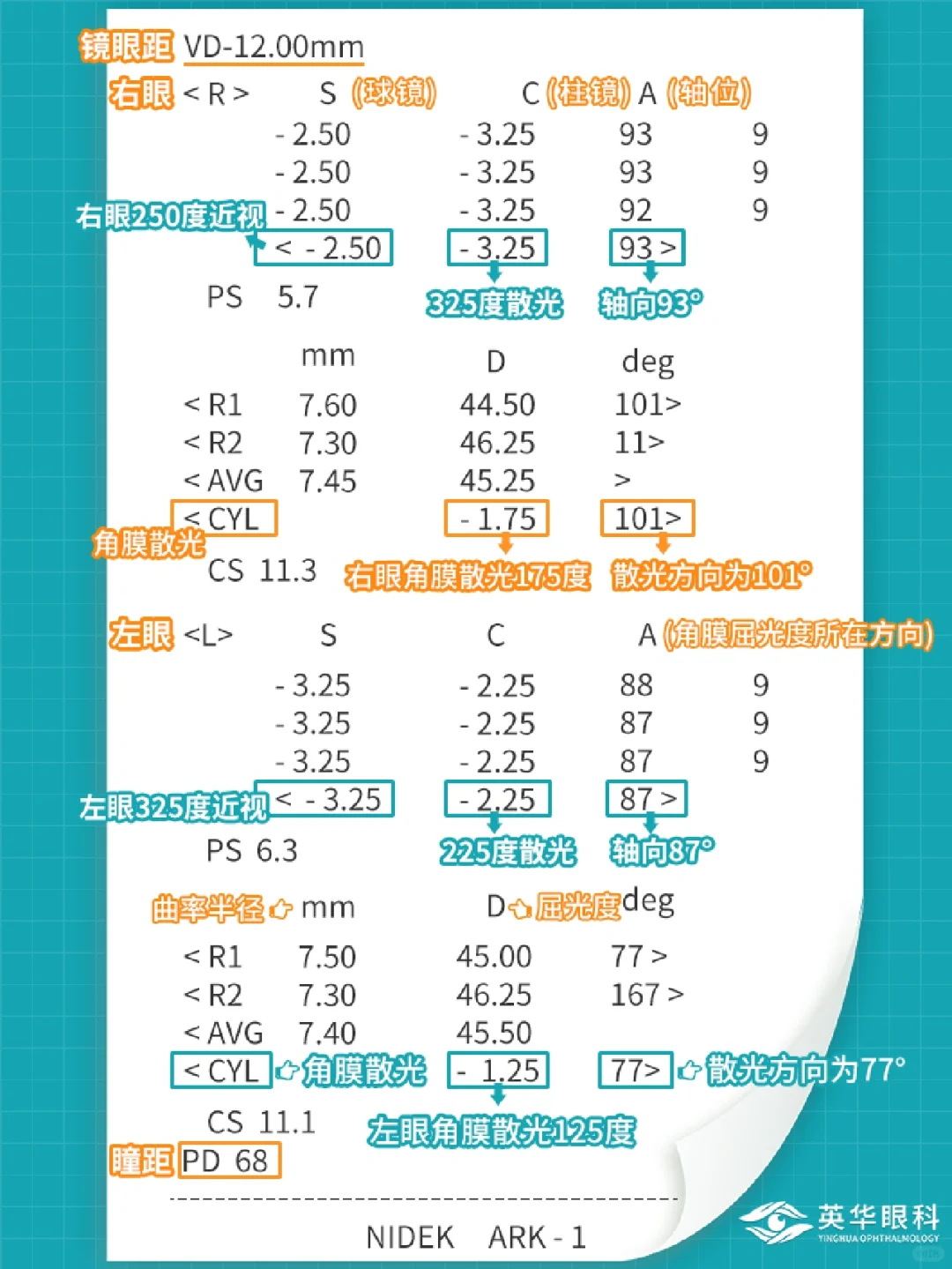 1⃣️分钟教会你怎么看懂电脑验光单❓