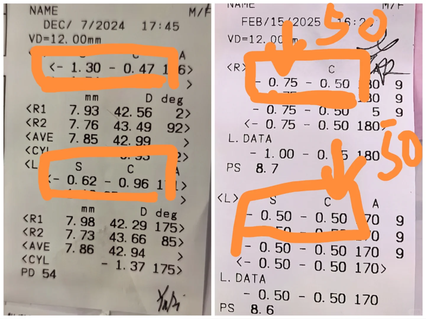 近视防控阶段成果：