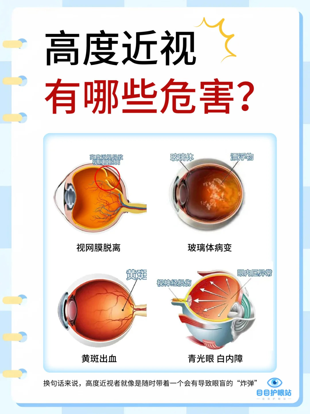 ?三分之一的盲人都是高度近视导致的！