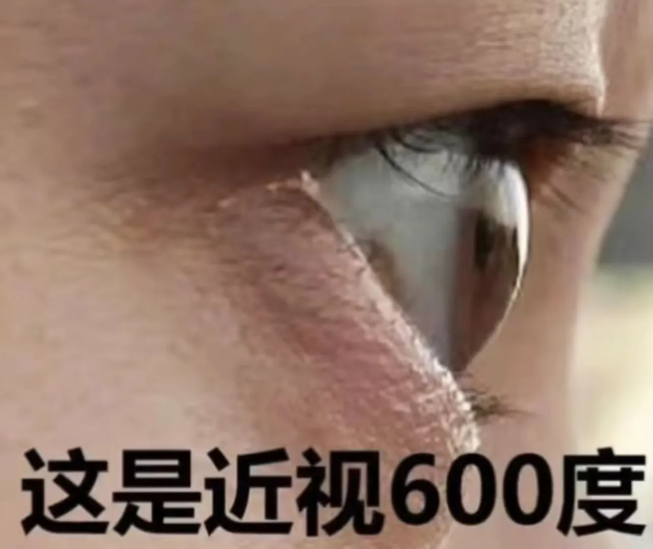 涨度数除了镜片的厚度，还有眼球的变化哦