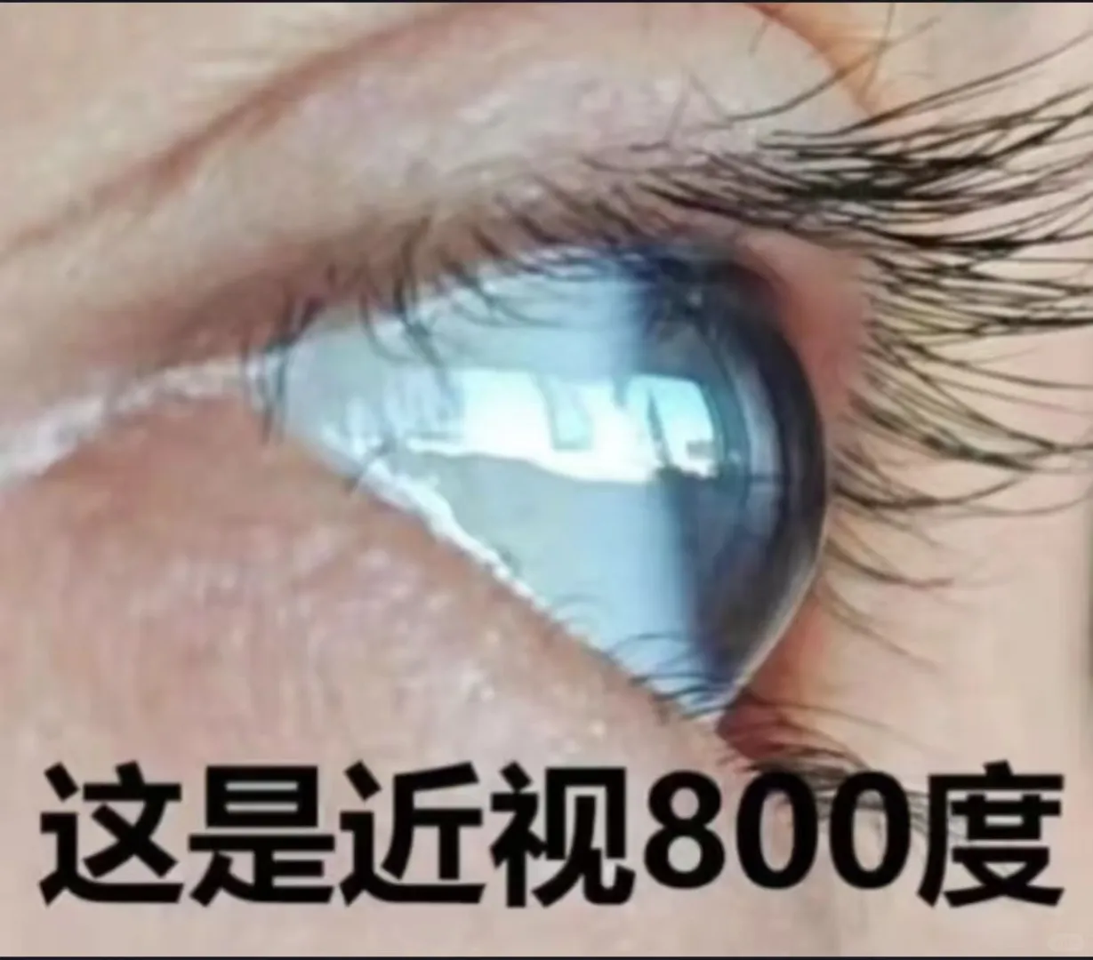 涨度数除了镜片的厚度，还有眼球的变化哦