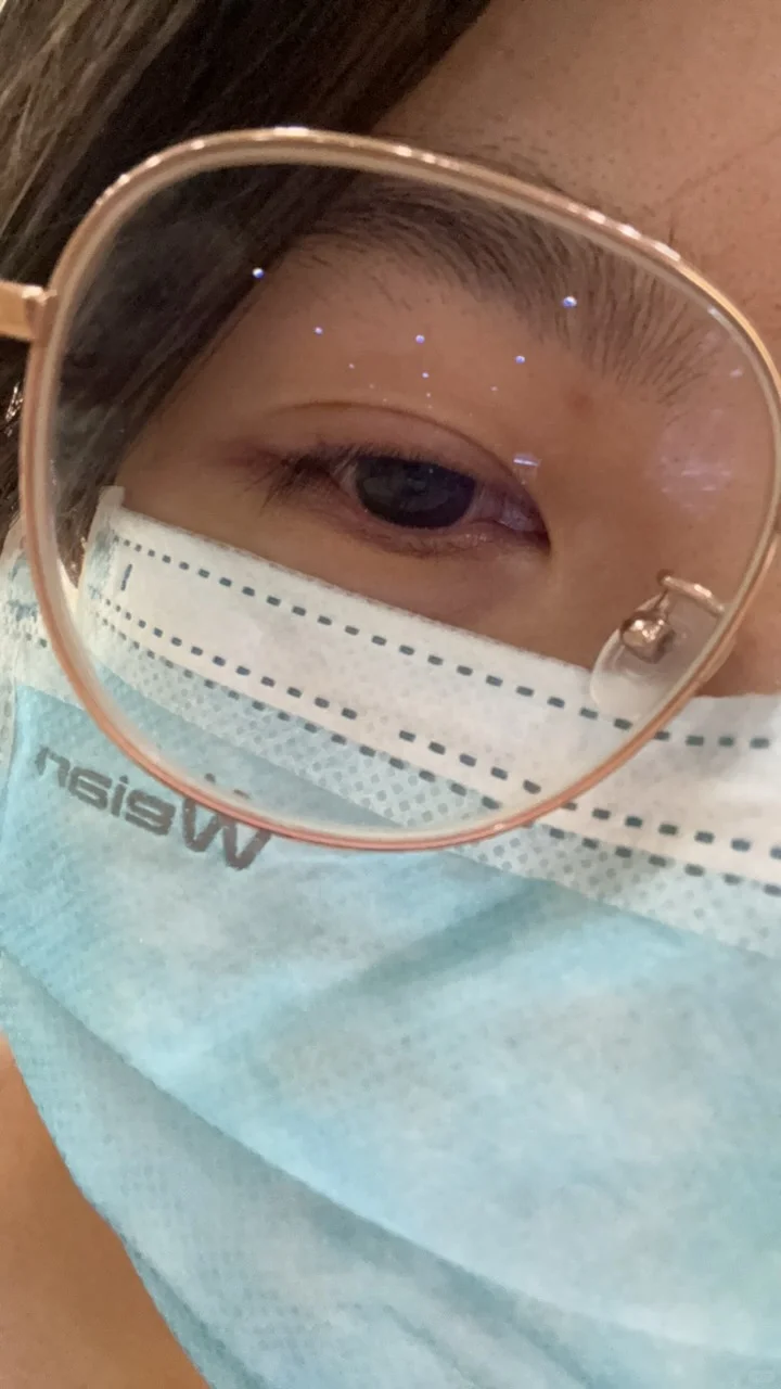 天塌了，研究生一年多近视涨一百度