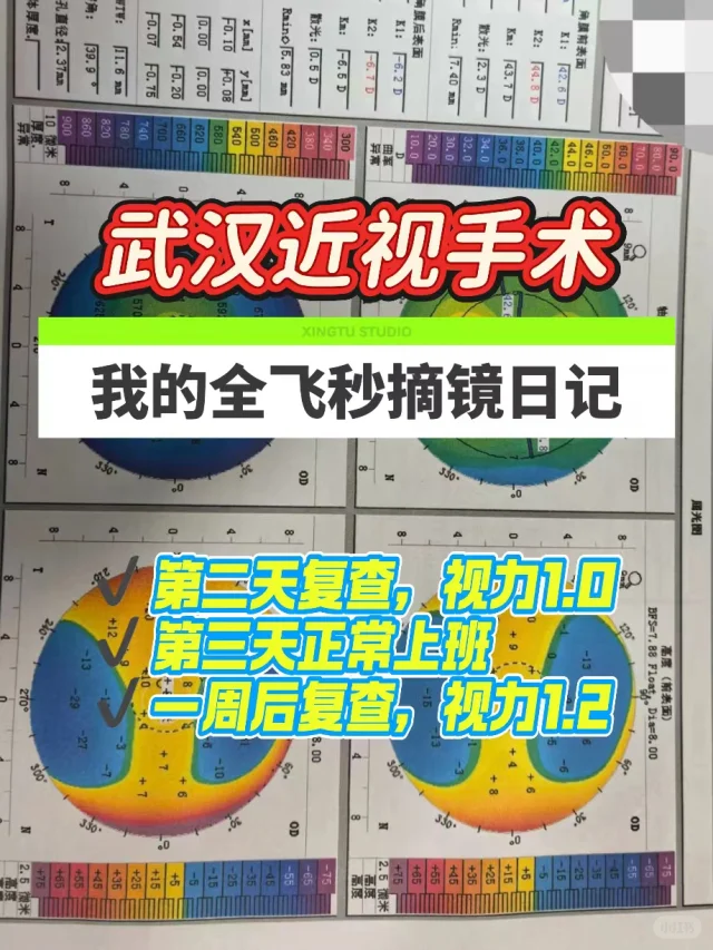 武汉近视手术｜我的全飞秒摘镜日记