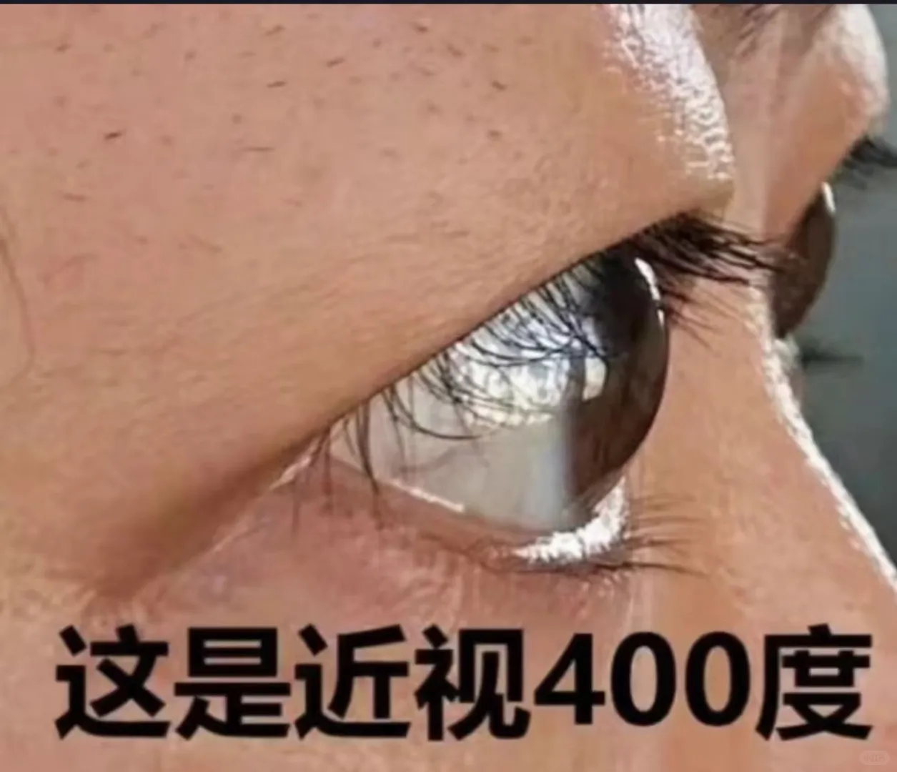 涨度数除了镜片的厚度，还有眼球的变化哦