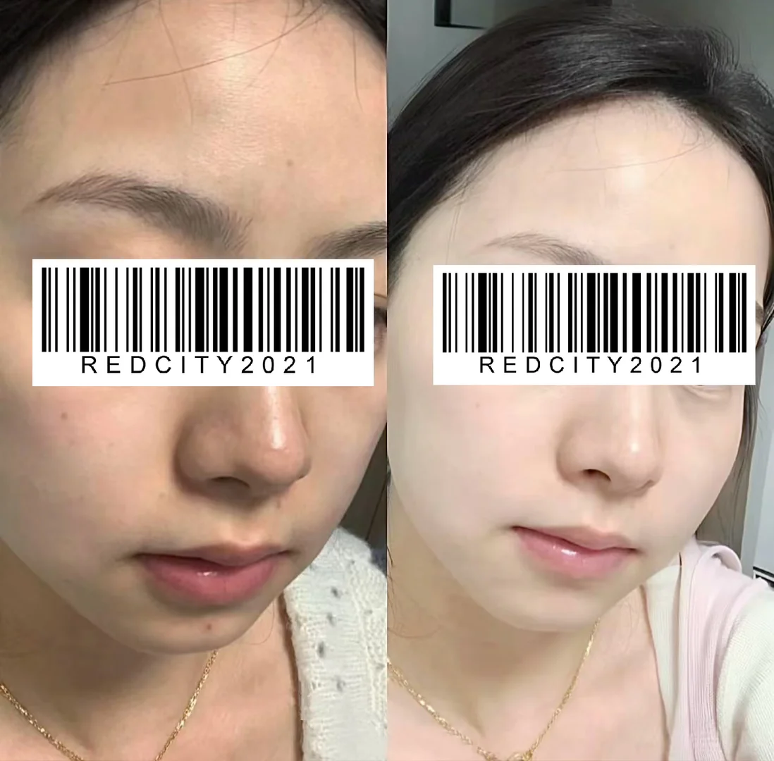 细胞级K衰！像极了刚剥了壳的鸡蛋