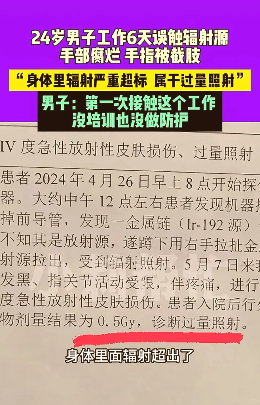 天呐！外面这种金属链条碰不得，一碰就截肢