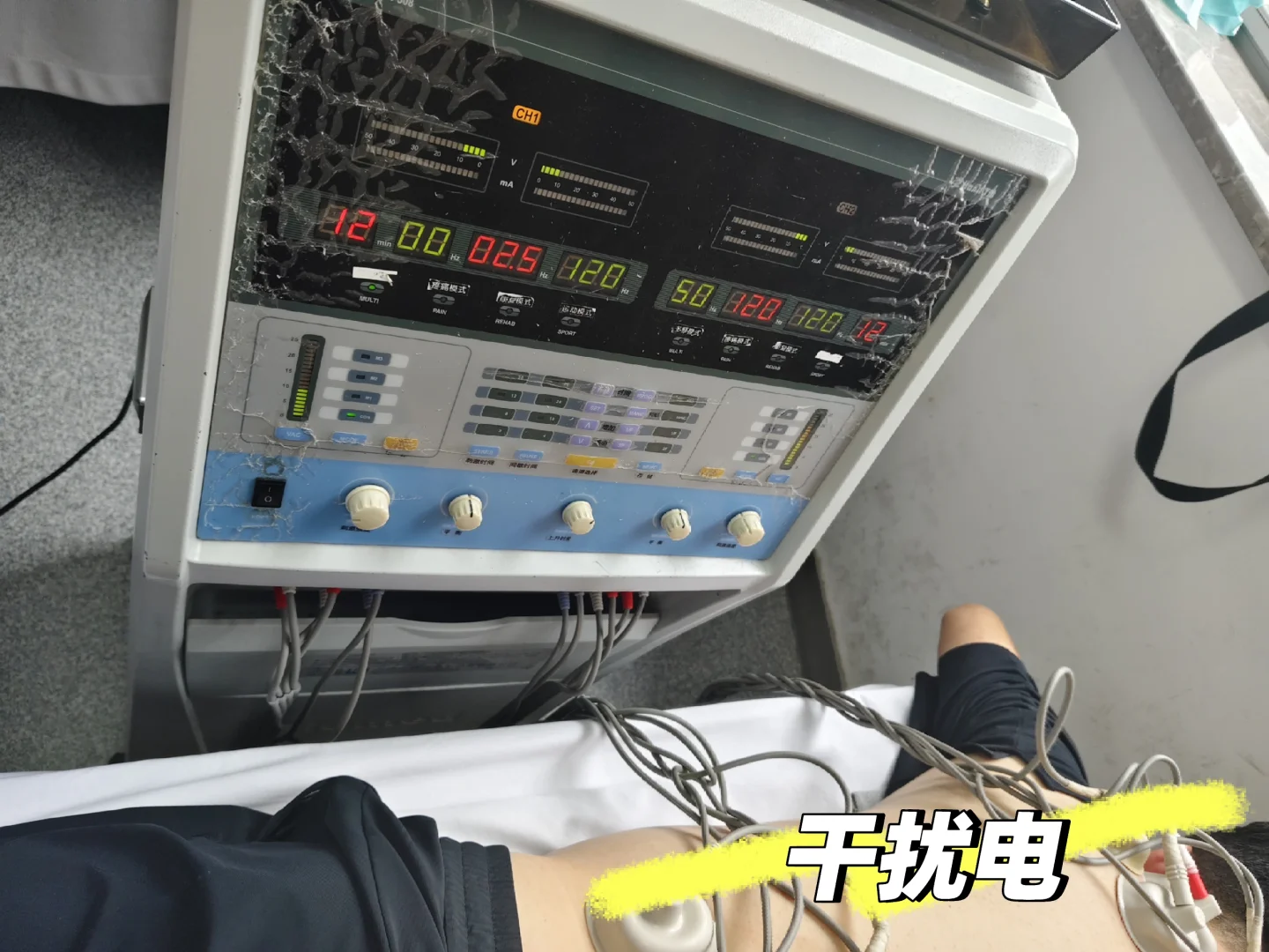 康复科理疗仪器大赏✨