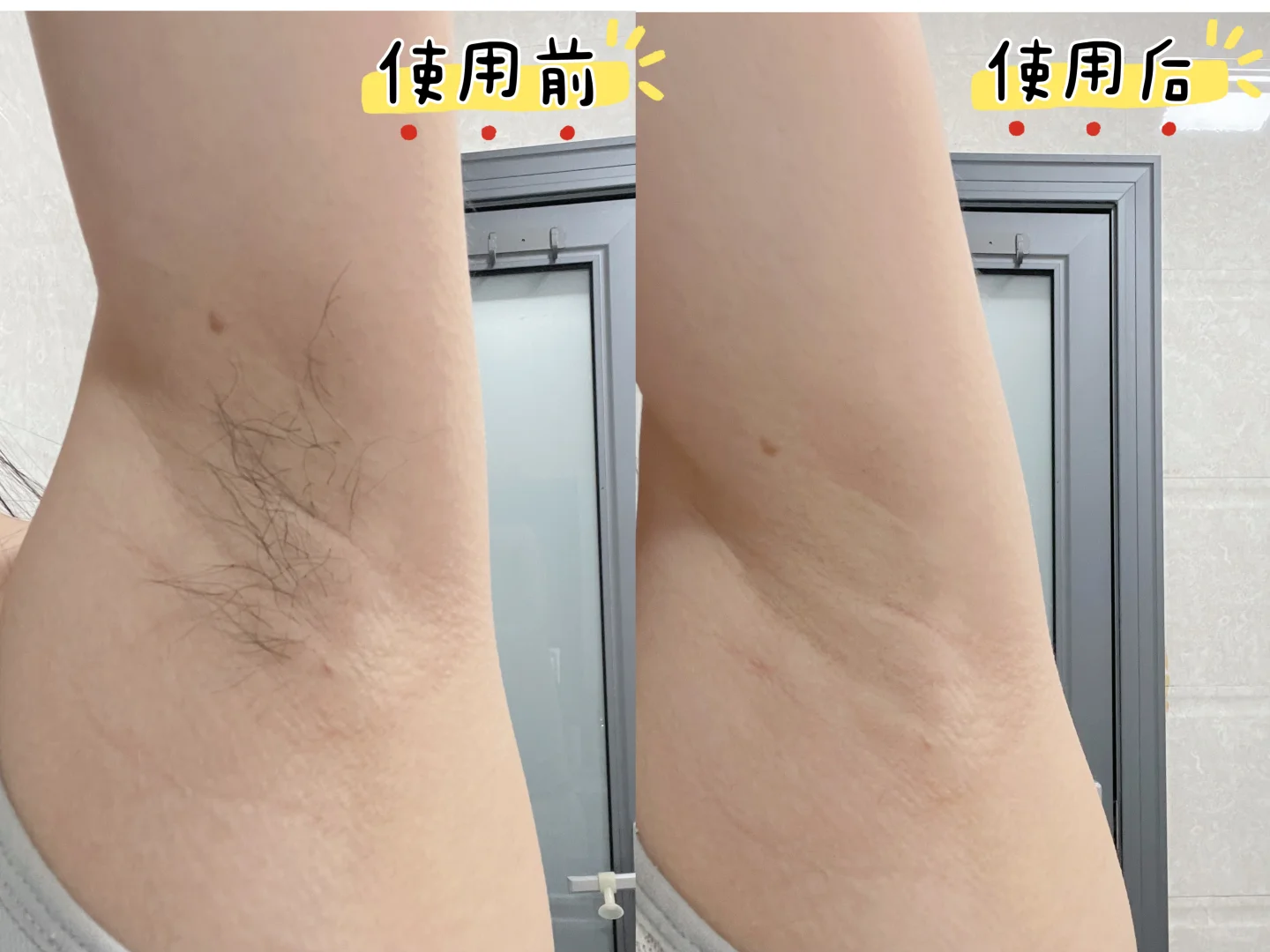 脱毛仪新手踩过的坑 进来看！