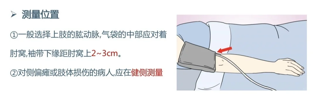 麻醉护士上线！天天用心电监护你掌握了多少