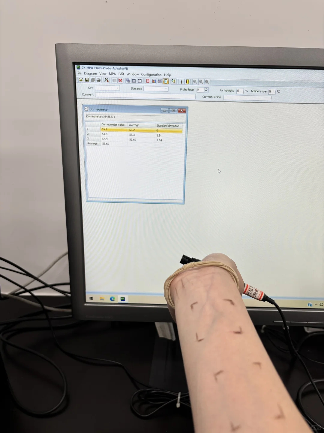 谁的学校还能免费做VISIA啊