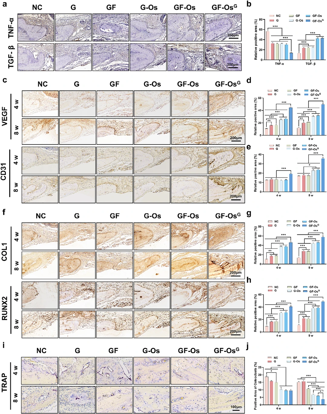 Adv. Mater. : 智能生物电池促糖尿病骨再生