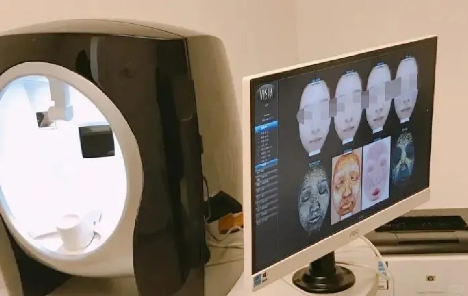 皮肤检测仪与易智拍的区别