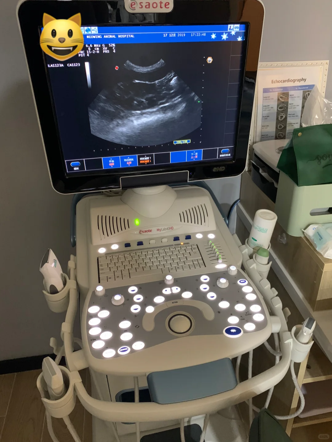 猜一猜这个彩超机的价格？