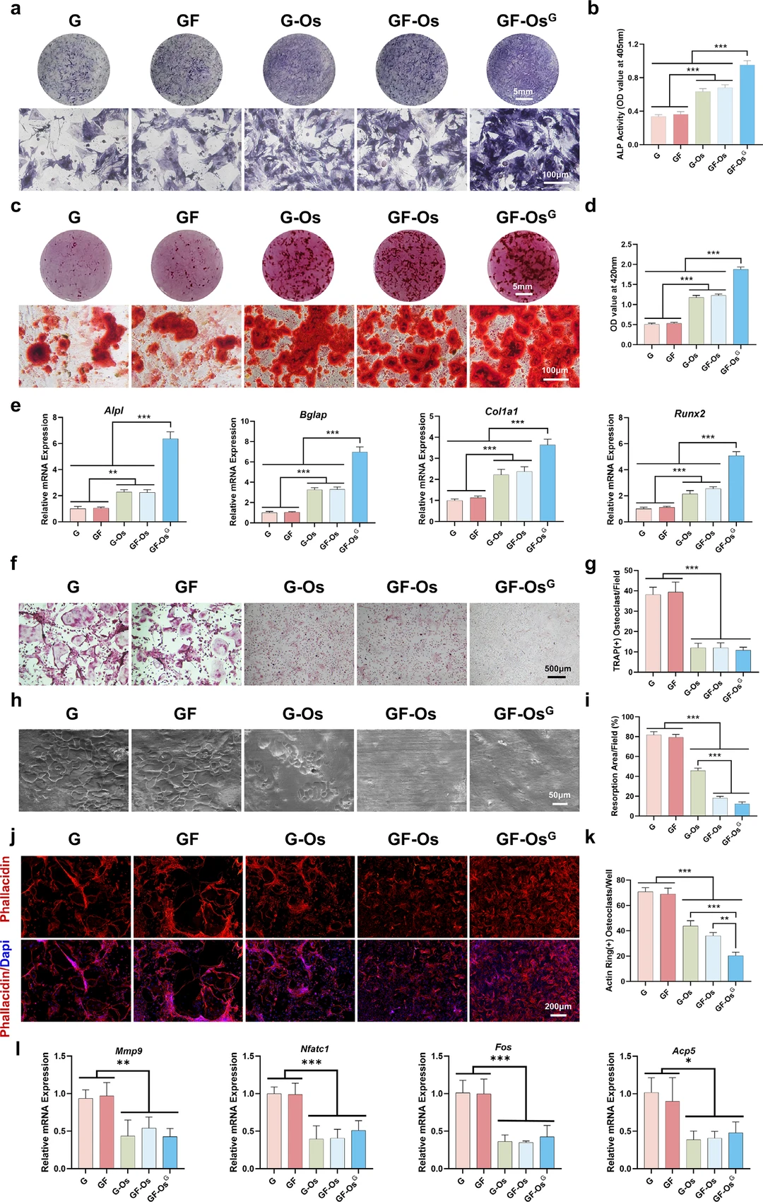 Adv. Mater. : 智能生物电池促糖尿病骨再生