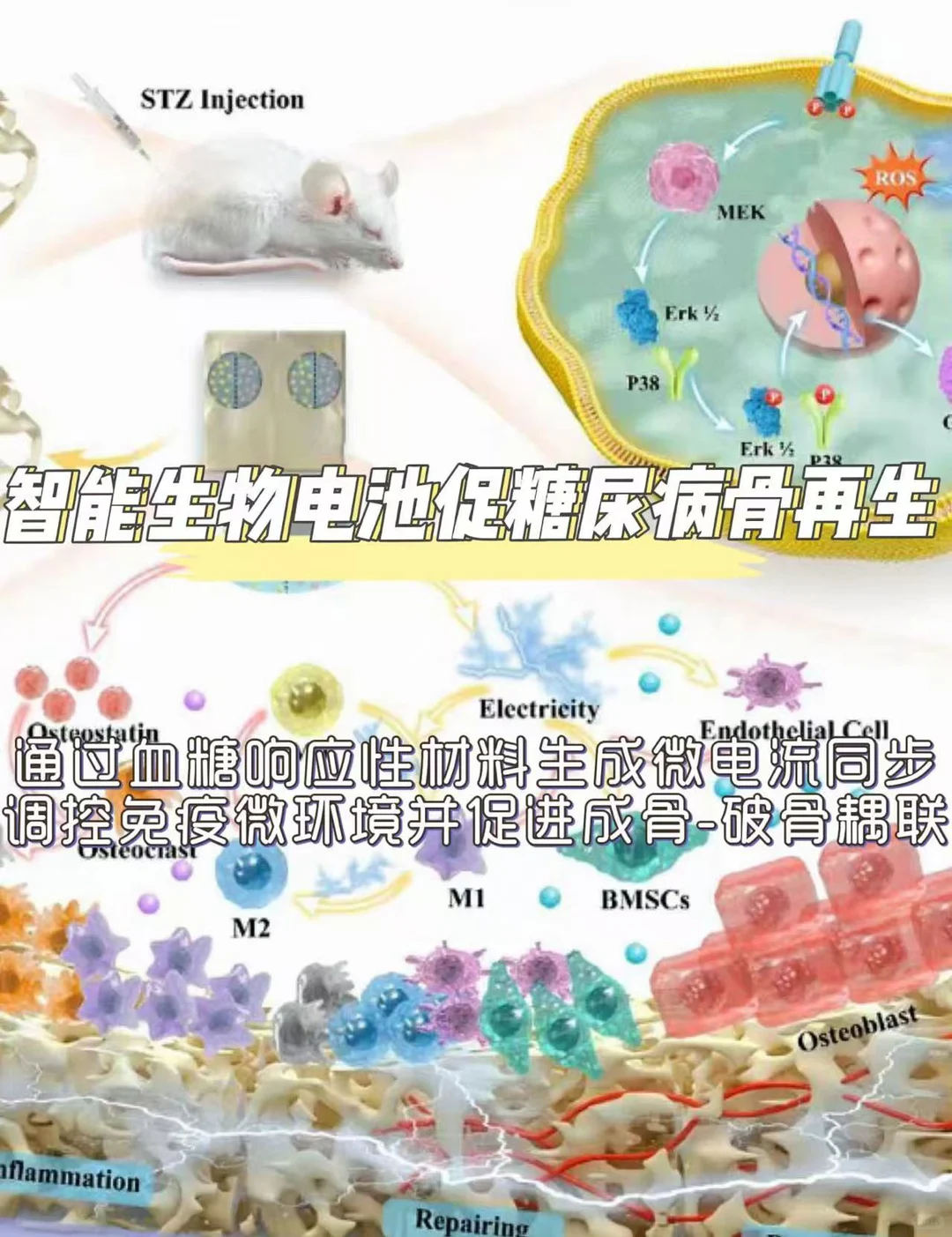 Adv. Mater. : 智能生物电池促糖尿病骨再生