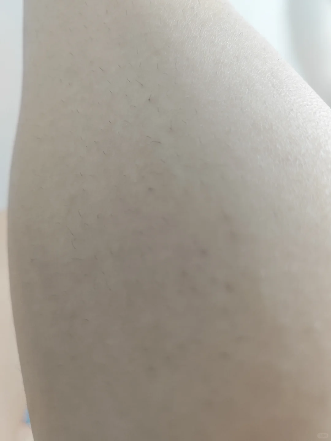 脱毛仪打卡第五天，腿部脱毛第三次