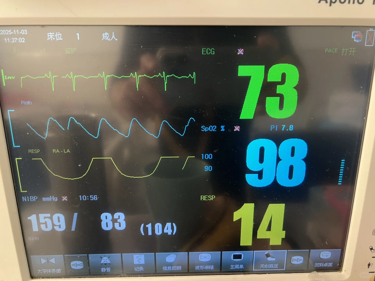 脑溢血(三)|医院监测仪怎么看?