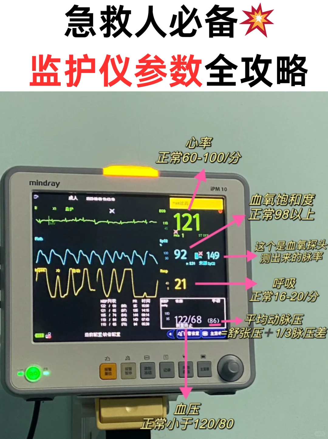让我看看谁还不会看心电监护仪‼️
