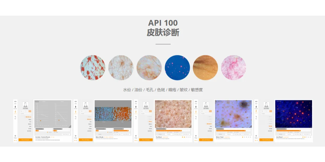 皮肤沙龙的秘密武器??