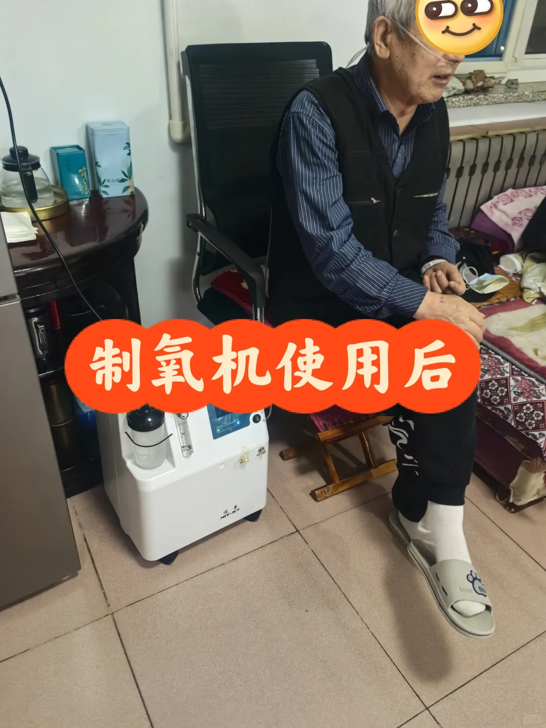 吸氧机用后反馈