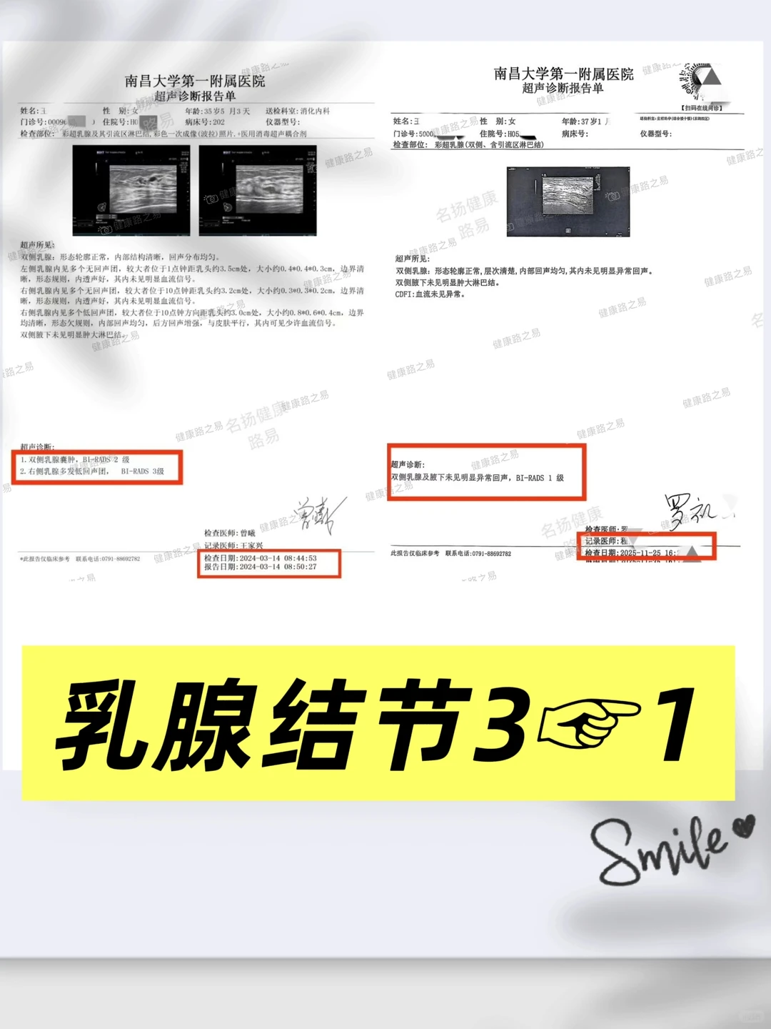 健康管理收获意外的惊喜～结节改善