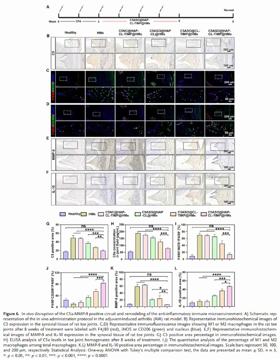 ?补体系统遇上“智能水弹”治疗RA