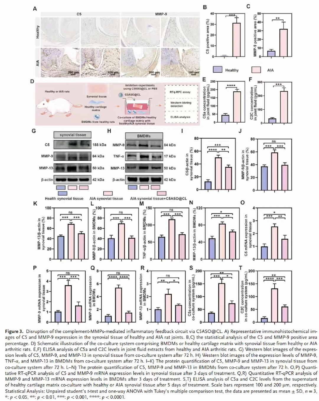 ?补体系统遇上“智能水弹”治疗RA