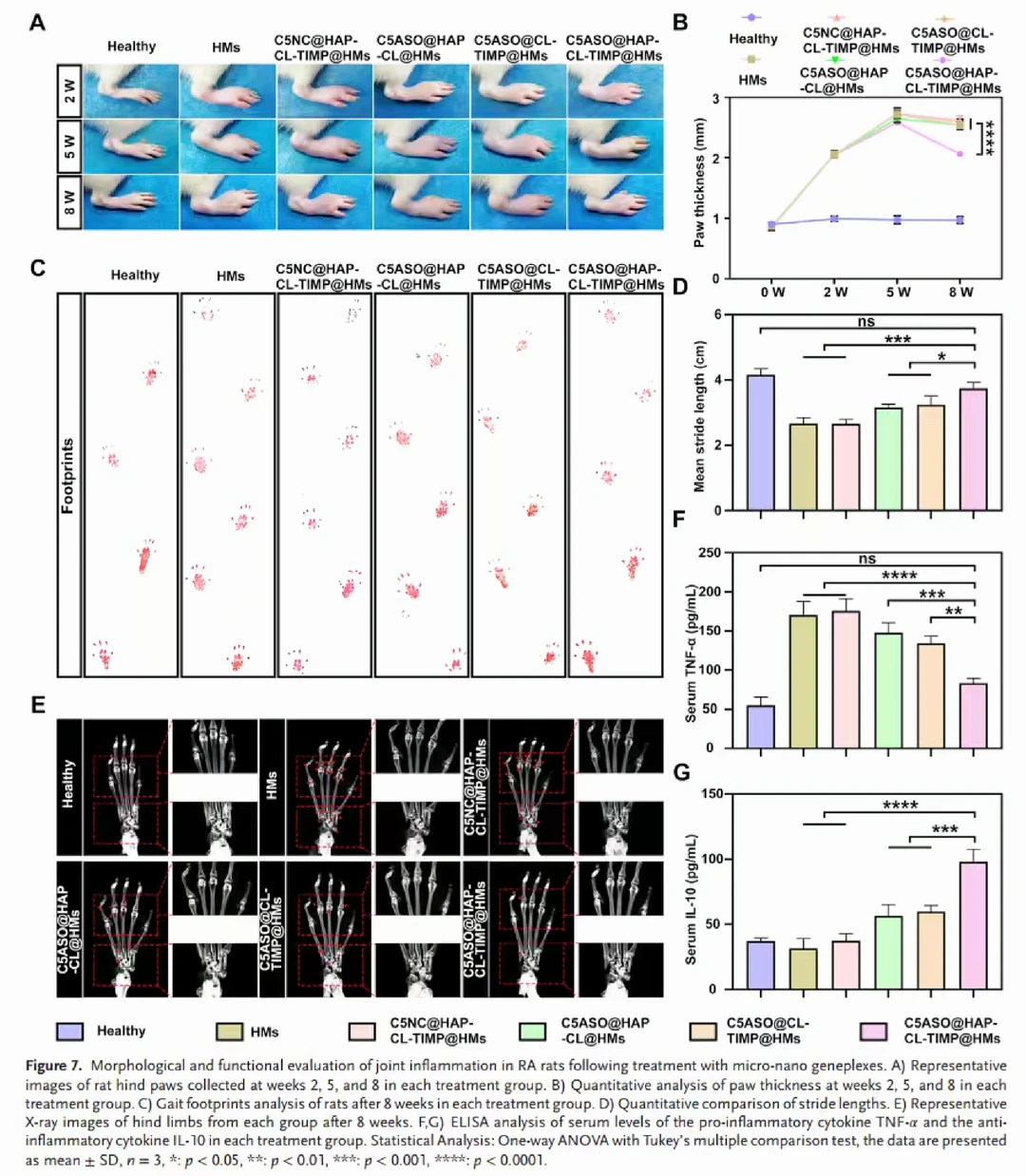 ?补体系统遇上“智能水弹”治疗RA