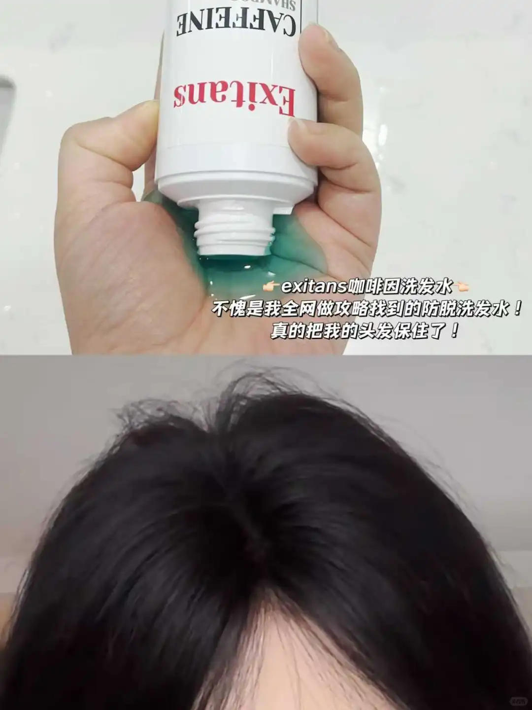 逆袭发量暴发户只需要选对防脱洗发水！！