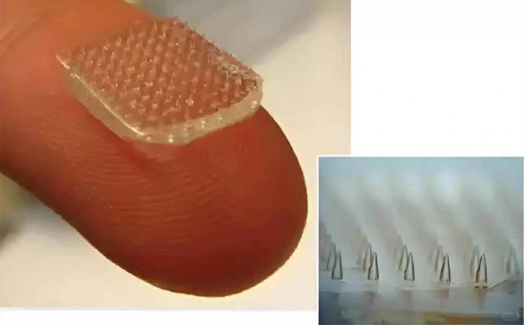 水凝胶微针制备，可定制药物释放，方案表征