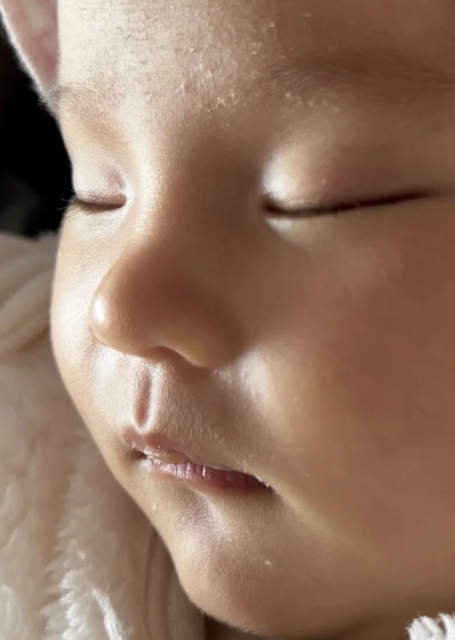 这个鼻梁会长出来的不?