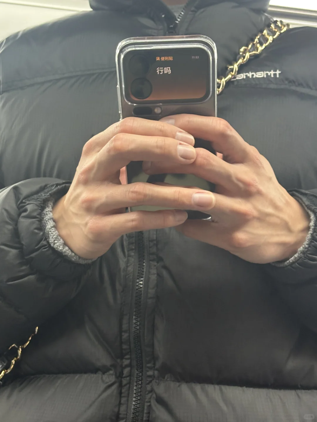 没有背屏应该怎么回应他小米17系列