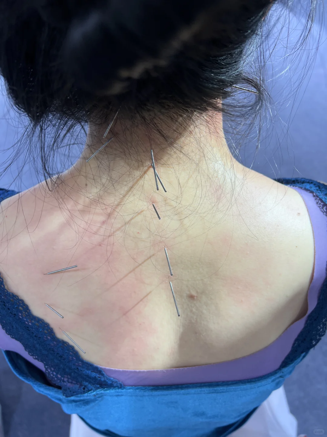 不虚此行！东北亚中医药健康博览会