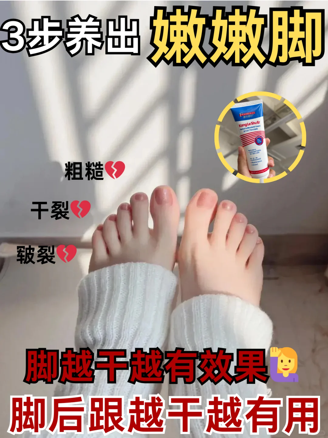 夏天不敢穿凉鞋？这支修护膏让死皮连夜搬家
