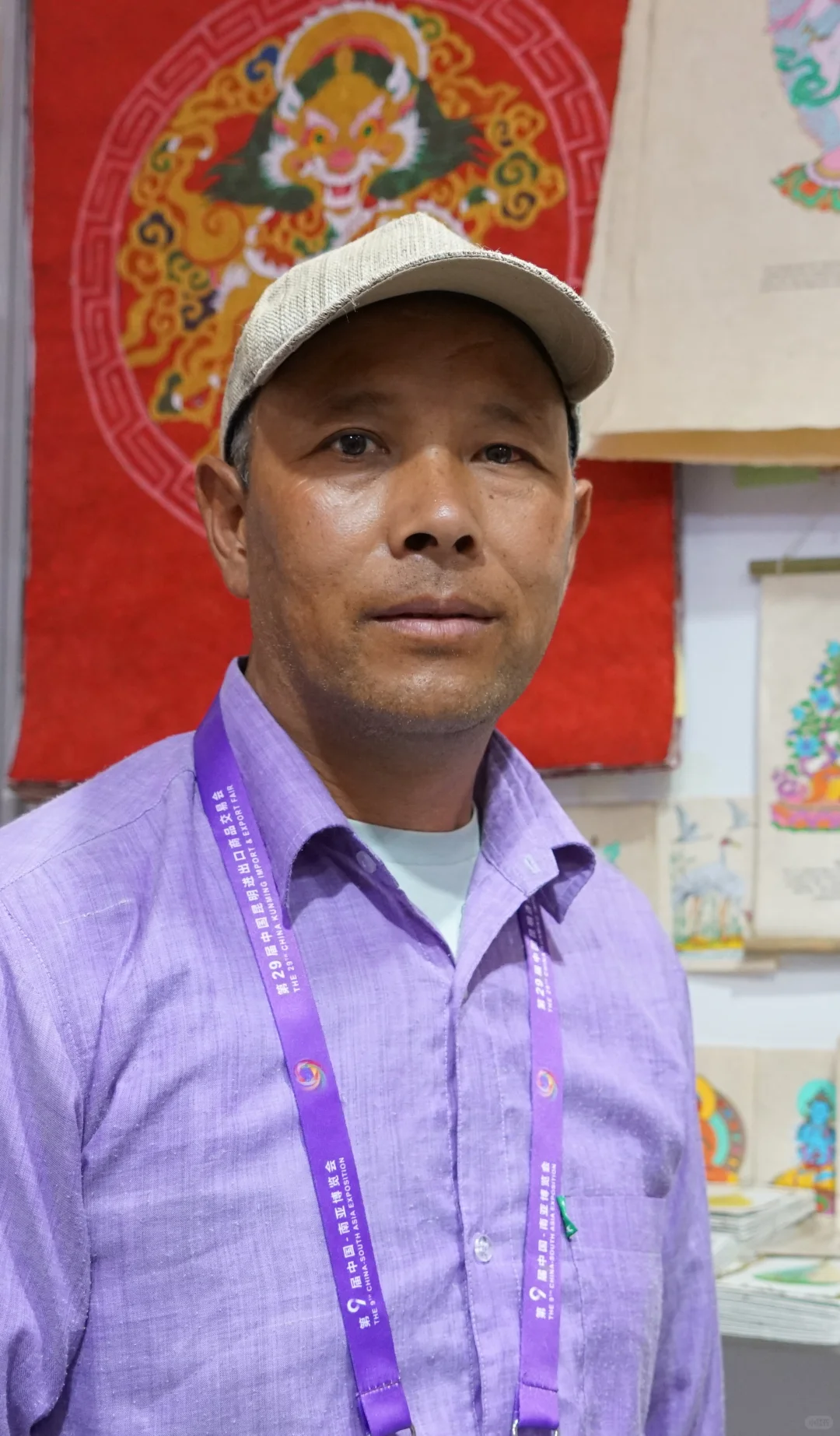 南博会尼泊尔大叔压力过大、球结膜出血