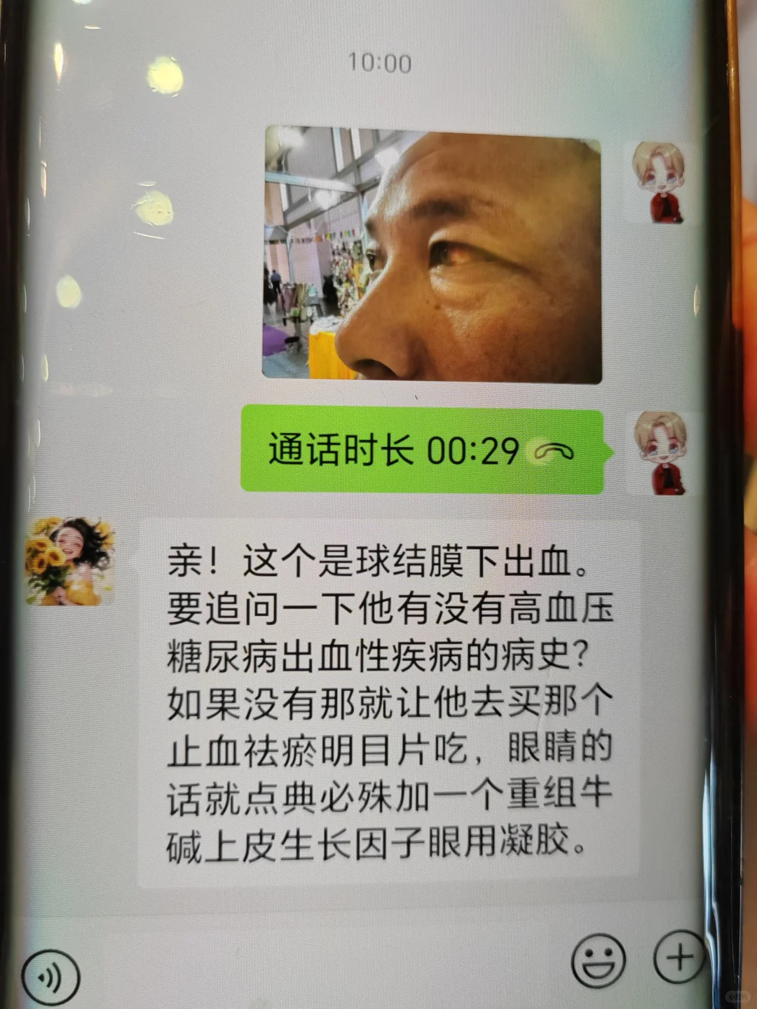 南博会尼泊尔大叔压力过大、球结膜出血