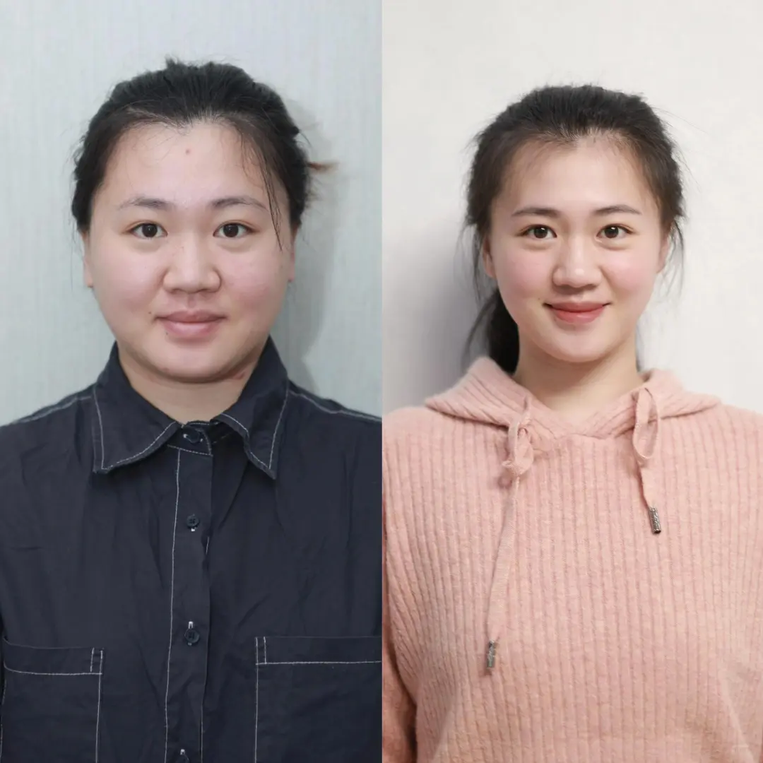 胰岛素抵抗减肥瘦了的变化