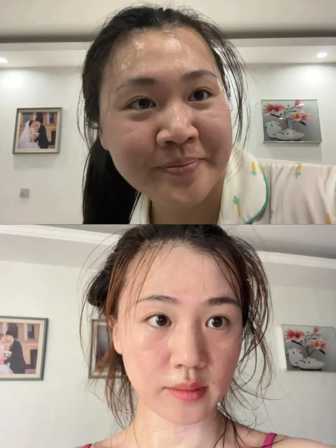 胰岛素抵抗减肥瘦了的变化